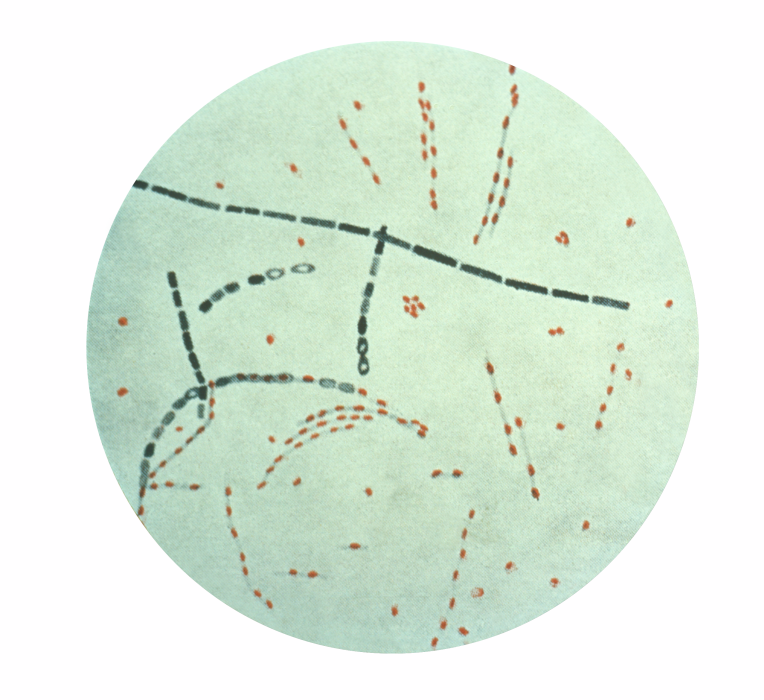 Bacillus anthracis