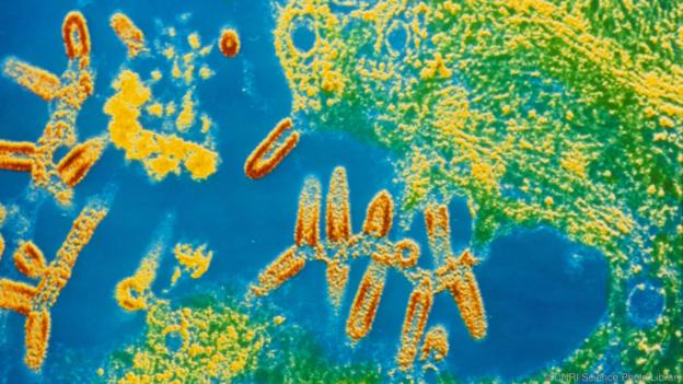 Вирус, причинител на бяс, излизащ от клетка на приемник. Credit: CNRI/Science Photo Library