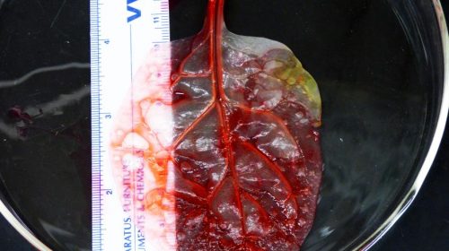 Снимка на листо от спанак след като успешно е демонстрирало, че червената боя може да се изпомпва през жилите му, симулирайки кръвта, кислорода и хранителните вещества, от които има нужда тъканта от човешко сърце, за да расте. Credit: WORCESTER POLYTECHNIC INSTITUTE