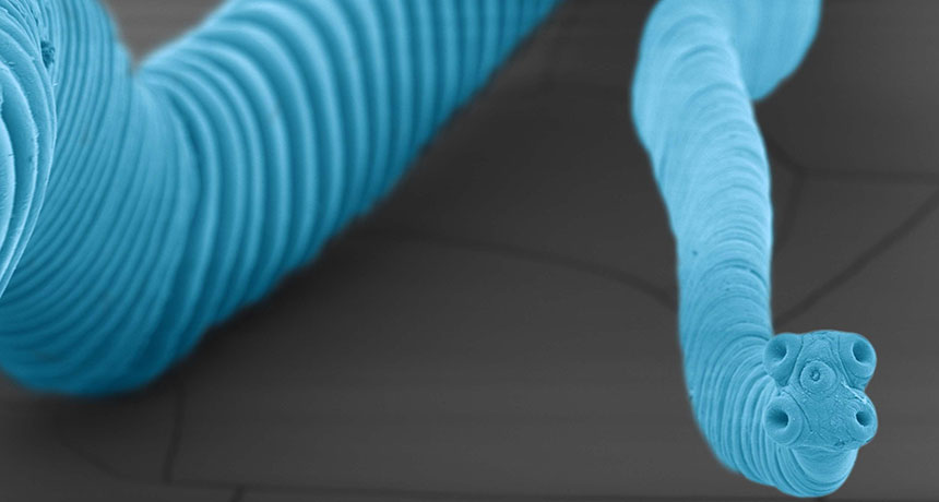 110415_ti_tapeworm_new.jpg