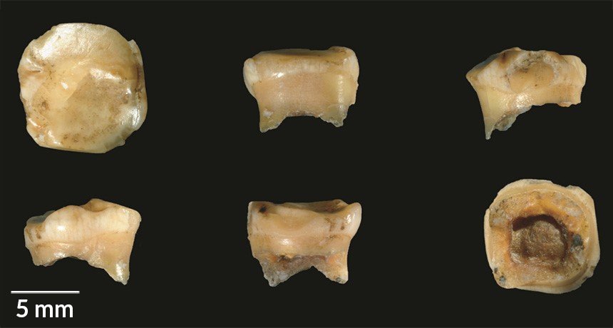 Износеният зъб на 10-12-годишно момиче, открит е в пещера в Сибир, датира от преди поне 100 000 години, докладват изследователи. Това превръща този фосил, представен под различни ъгли, в най-древния сред родствено на неандерталците население, наречено денисови хора. Credit: V. SLON ET AL/SCIENCE ADVANCES 2017