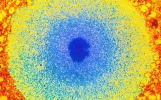 Телце на Леви, съставено главно от протеина алфа-синуклеин (в синьо), в неврон. Телцата на Леви са патологичният признак при болестта на Паркинсон. Credit: Lysia Forno/Science Source