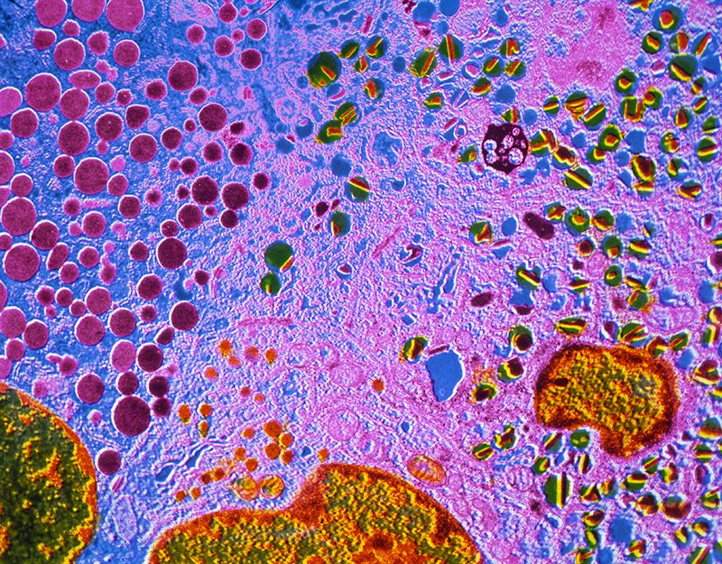 Електронно-микроскопска снимка на панкреатични клетки в острови на Лангерханс. Credit: CNRI/SPL