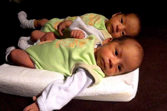 Първите полуидентични близнаци, идентифицирани като такива по време на бременността