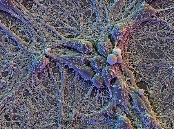 Brain-cells-from-visualsunlimited.photoshelter.jpg