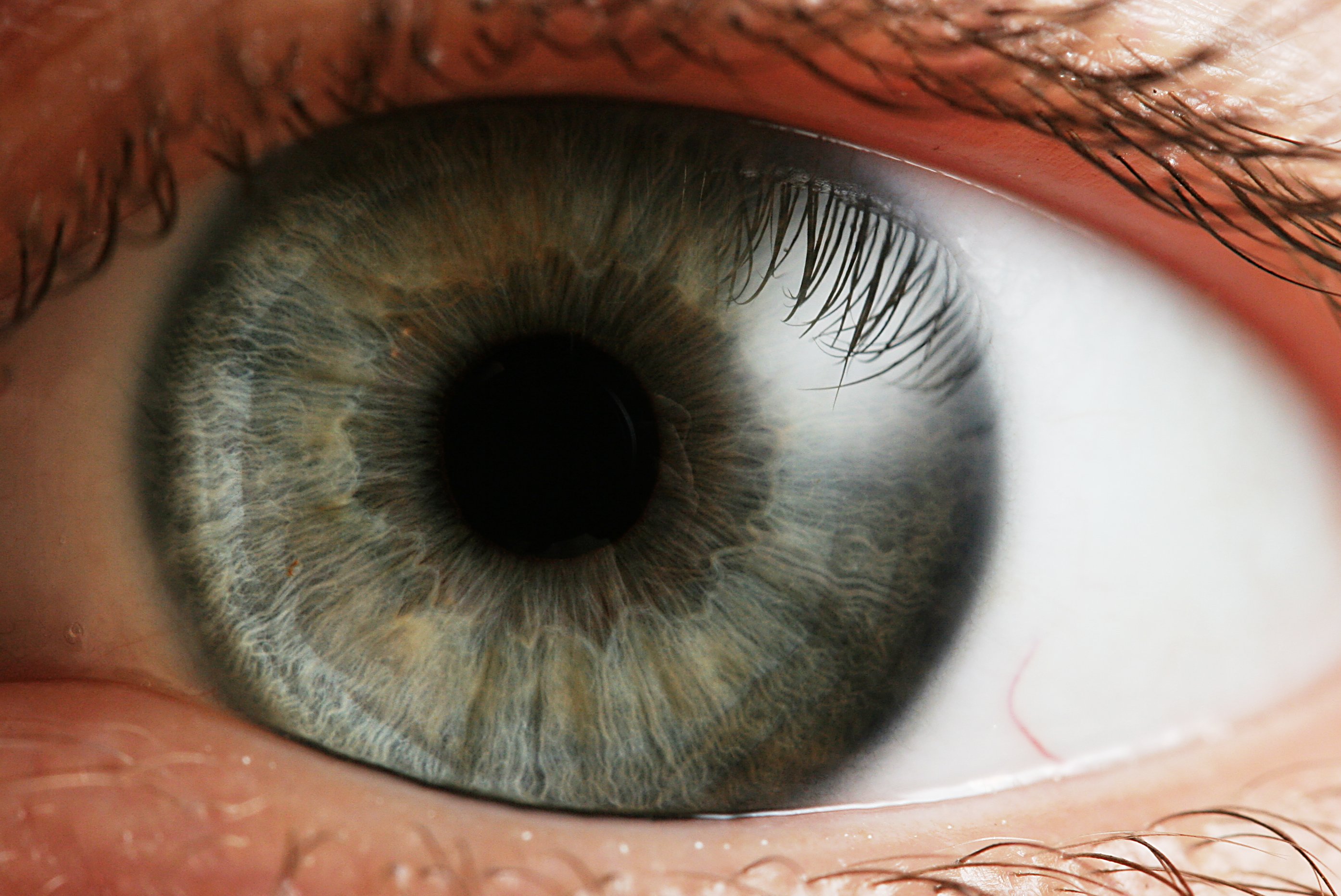 Сляпа жена възстановява зрението си след противоречива терапия със стволови клетки
