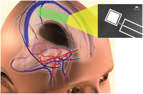 glucose-fuel-cell-in-brain.jpg