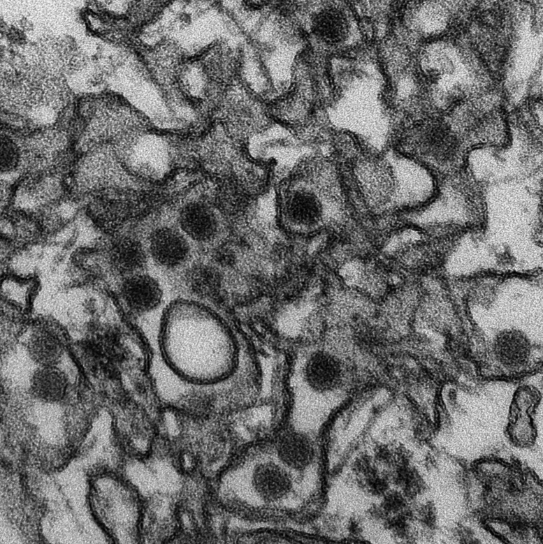 zika_virus.jpg